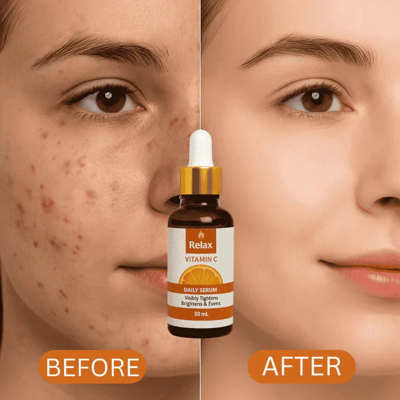 🌞 Relax Vitamin C Serum – Instant Glow