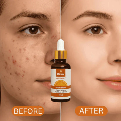 🌞 Relax Vitamin C Serum – Instant Glow